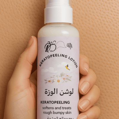 لوشن معالج لجلد الوزة 100 ملى 